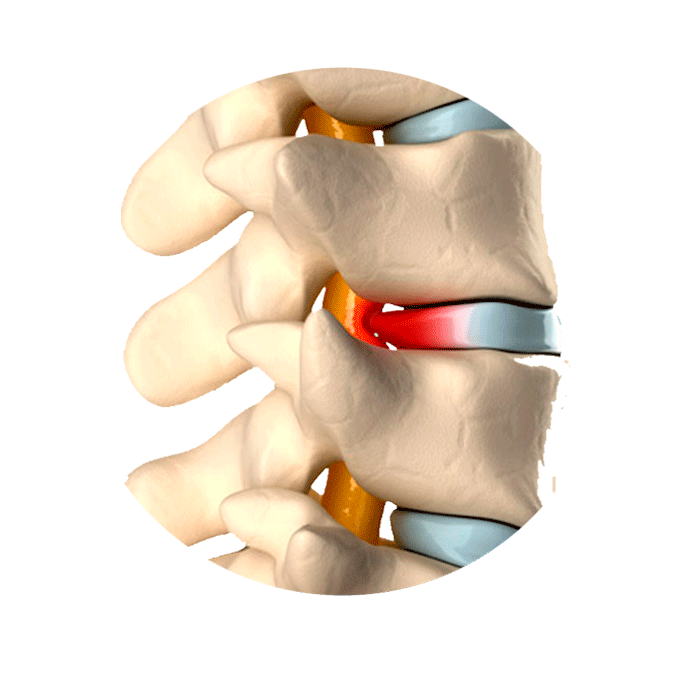Columna Vertebral